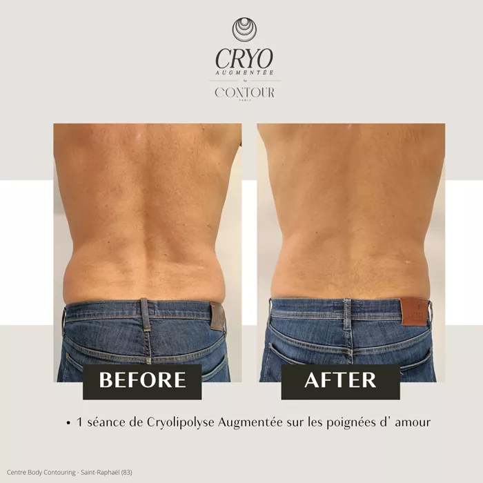 bel-oceane-minceur-1303264