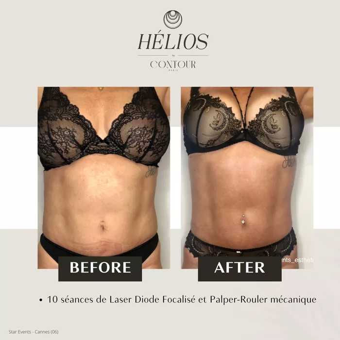 bel-oceane-minceur-1303265